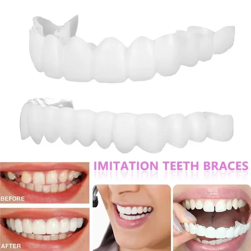 Transform Your Smile with Upper and Lower Comfort Fit Flex Dentures - Perfect Bright Veneers for a Natural Look