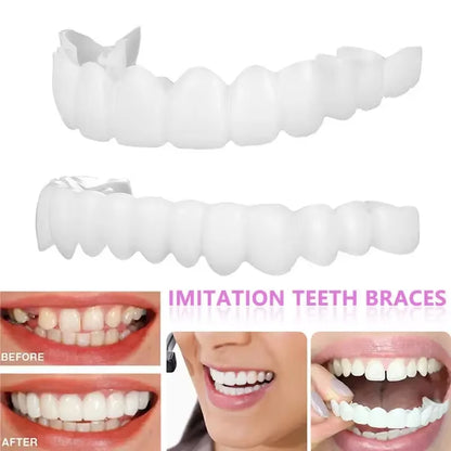 Transform Your Smile with Upper and Lower Comfort Fit Flex Dentures - Perfect Bright Veneers for a Natural Look