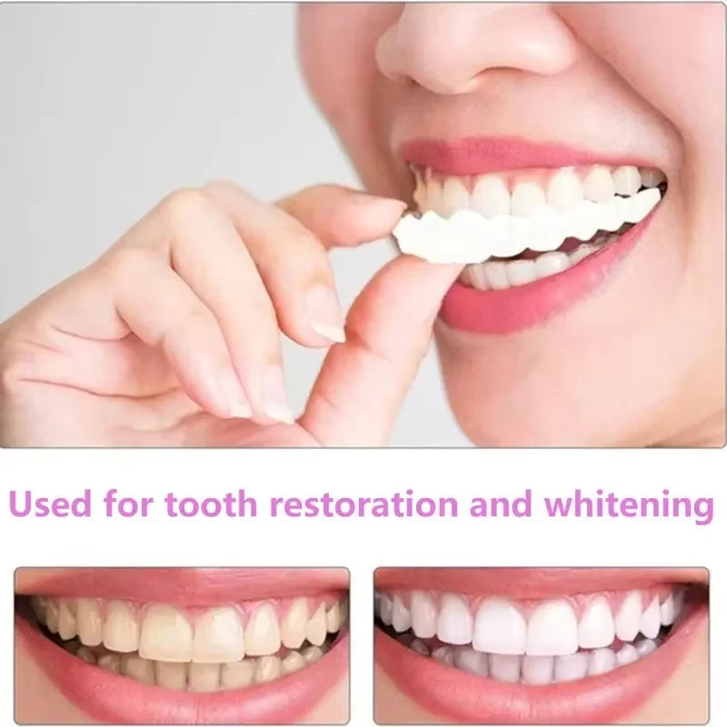 Transform Your Smile with Upper and Lower Comfort Fit Flex Dentures - Perfect Bright Veneers for a Natural Look