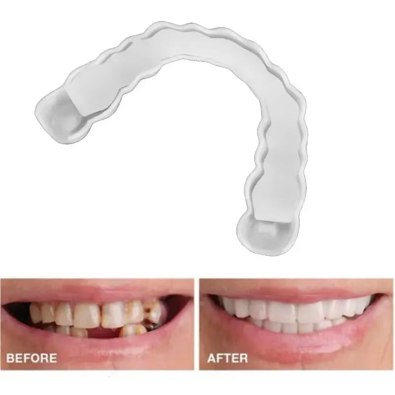 Transform Your Smile with Upper and Lower Comfort Fit Flex Dentures - Perfect Bright Veneers for a Natural Look
