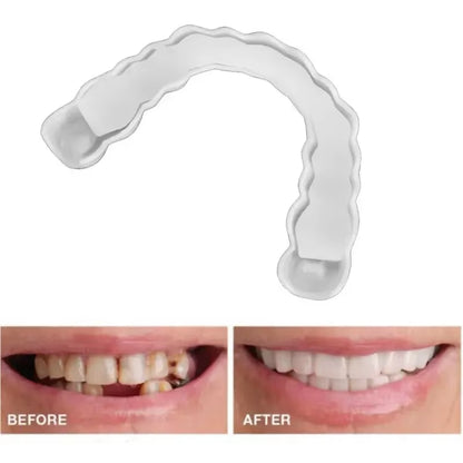 Transform Your Smile with Upper and Lower Comfort Fit Flex Dentures - Perfect Bright Veneers for a Natural Look